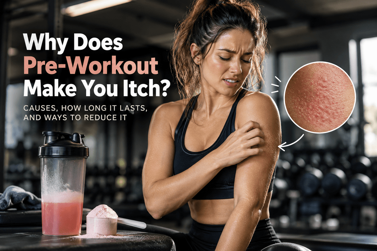 Why Does Pre-Workout Make You Itch?